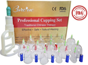 cupping therapy set